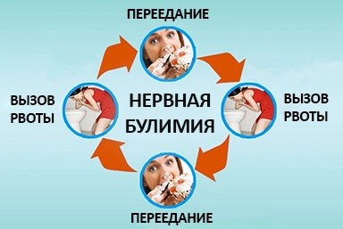 Лечение булимии в Ясиноватой